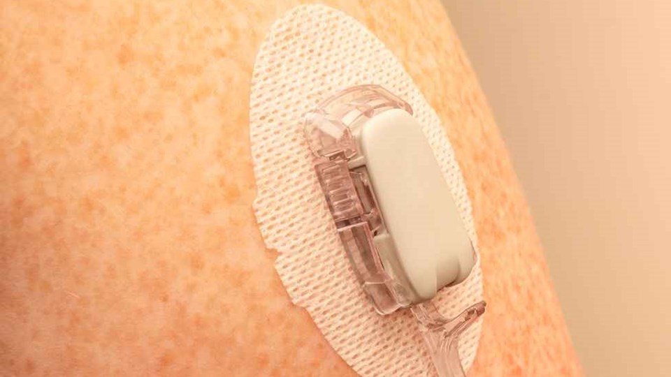 Top Wearable Adhesive Tapes for CGM Applications